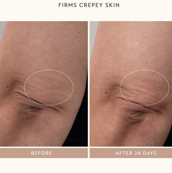 NIB SHANI DARDEN BODY REFORM TREATMENT SERUM - Picture 11 of 16